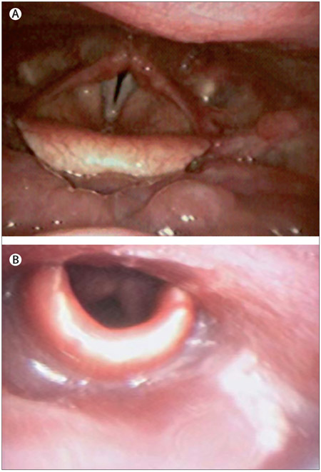 Figure 5: