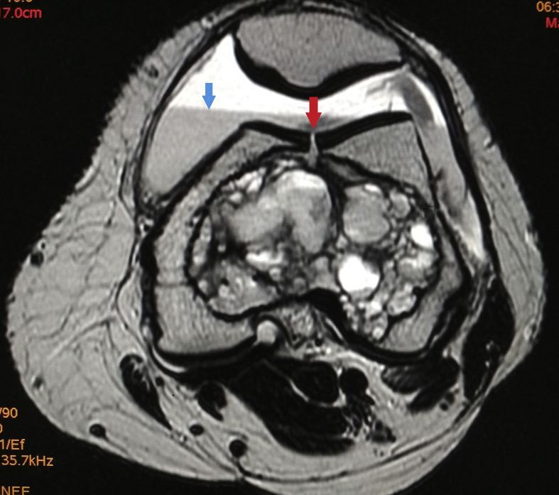 Fig. 5