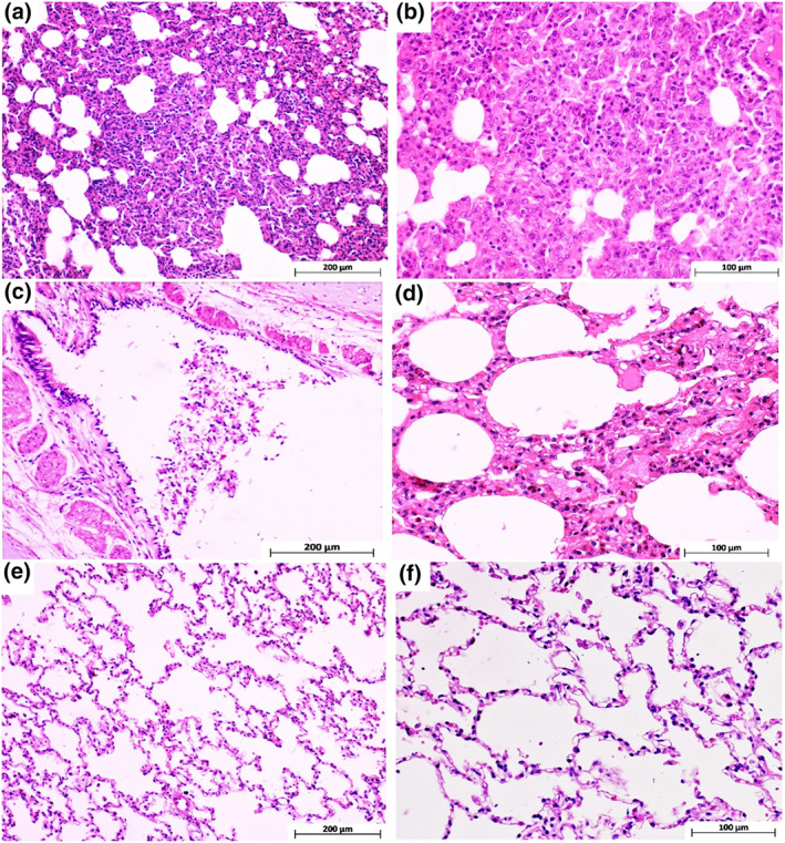 FIGURE 15