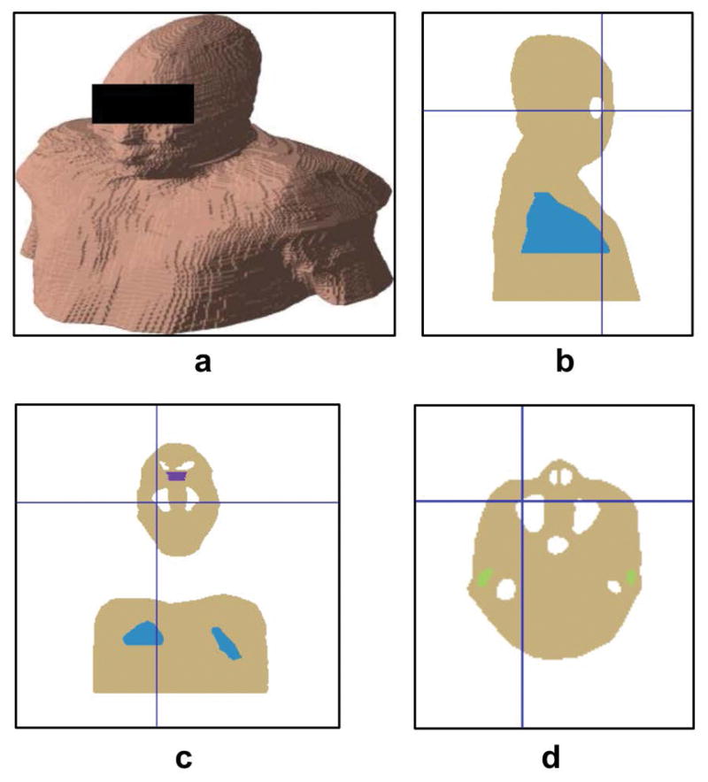 FIG. 5