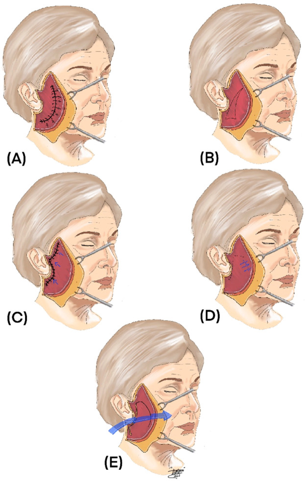 Figure 2: