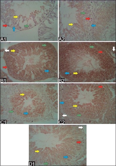 Figure-5