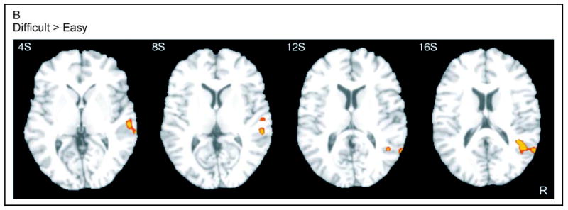 Figure 4B