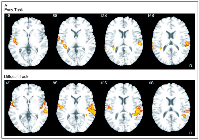 Figure 4A