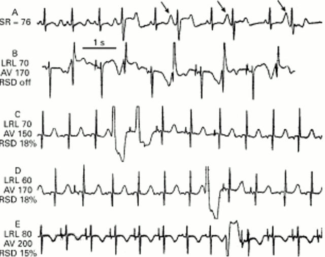 Figure 2  