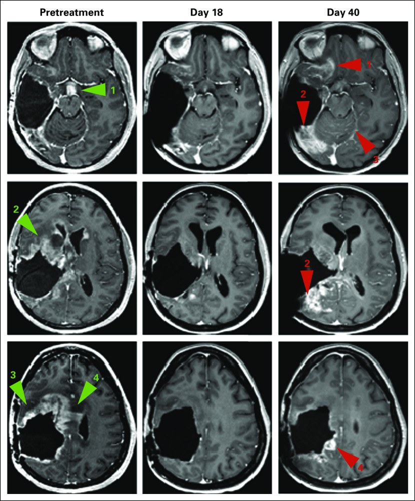 Fig 2.