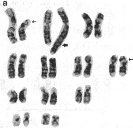 graphic file with name pnas00351-0213-a.jpg