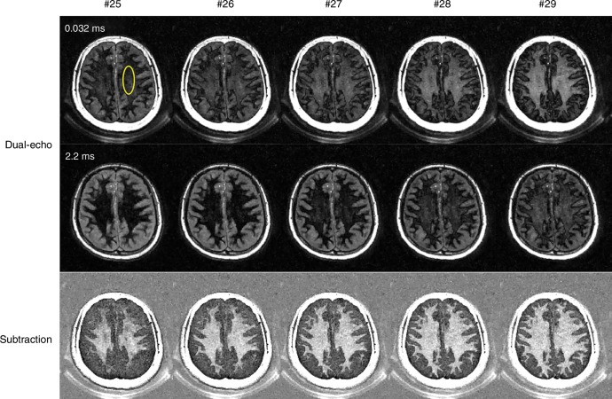 Figure 4b: