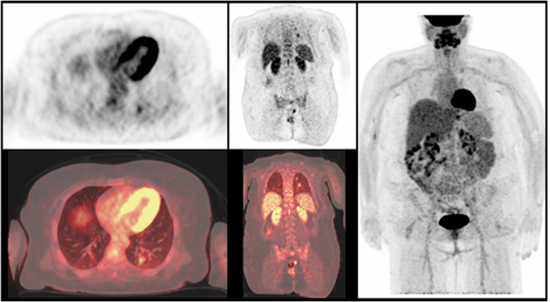 Fig. 1