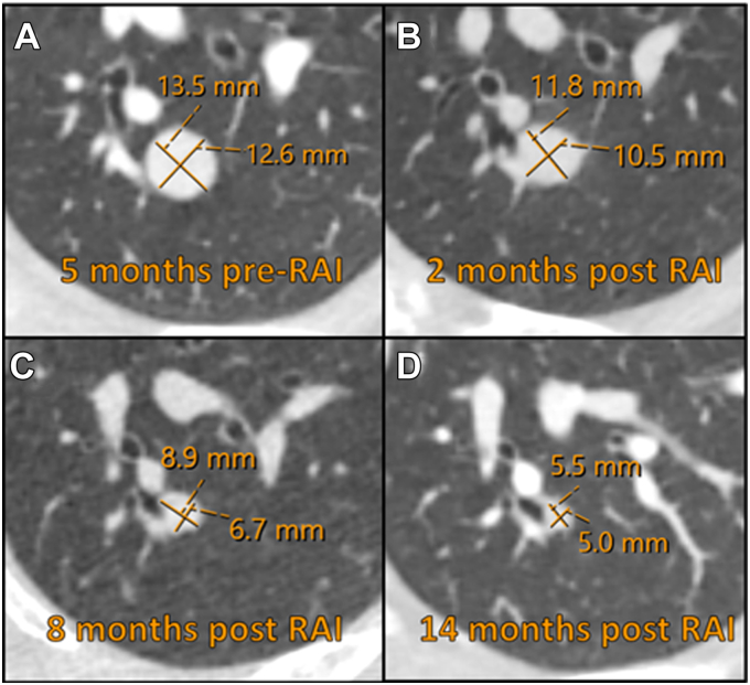 Fig. 4