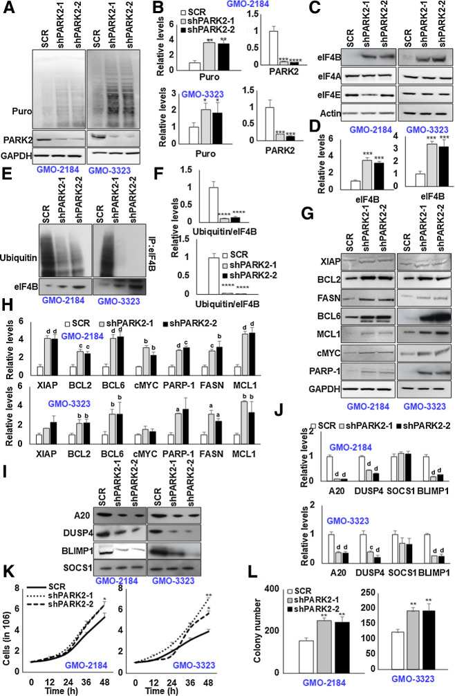 Figure 2. Depletion of PARK2 augments eIF4B signaling. A, PARK2-depleted stable GMO cells (2184, 3323) were cultured in the presence of puromycin (3 μg/mL) for 30 minutes, and lysates were probed for defined antibodies. GAPDH was used as the loading control. B, Densitometric quantification of the immunoblots in A. Values were normalized with their corresponding loading controls and neutralized with corresponding SCR-infected cells, which was set as 1; represented as mean ± SD for n = 3. Statistical analysis was performed using one-way ANOVA followed by Dunnett post hoc analysis. *, P < 0.05; **, P < 0.01; ***, P < 0.005 versus SCR-infected cells. C, G, and I, PARK2-depleted stable GMO cells (2184, 3323) were probed for defined antibodies. Actin was used as the loading control. D, H, and J, Densitometric quantification of the immunoblots in C, G, and I, respectively. Values were normalized with their corresponding loading controls and neutralized with corresponding SCR-infected cells, which was set as 1; represented as mean ± SD for n = 3. Statistical analysis was performed using one-way ANOVA followed by Dunnett post hoc analysis. a, P < 0.05; b, P < 0.01; c, P < 0.005; d, P < 0.001 versus SCR-infected cells. E, PARK2-depleted stable GM-B cells (2184, 3323) were treated with C75 (10 μmol/L) for 8 hours. Posttreatment, eIF4B was enriched from the cellular lysates, and ubiquitin levels were determined by immunoblotting. F, Densitometric quantification of the immunoblots in E. Values were normalized with corresponding eIF4B levels and neutralized with their corresponding SCR-infected cells, which was set as 1; represented as mean ± SD for n = 3. Statistical analysis was performed using one-way ANOVA followed by Dunnett post hoc analysis. ****, P < 0.001 versus SCR-infected cells. K, Indicated PARK2-depleted stable cells were seeded 1 million per well in 6-well plates. After 12 hours, the cells were collected and counted using trypan blue. Values are expressed as mean ± SD (n  =  3), *, P < 0.05; **, P < 0.01 versus SCR-infected corresponding cells. L, The total number of colonies grown in PARK2-depleted cells in methylcellulose culture. Colony counts were performed on the 15th day of methylcellulose culture. **, P < 0.01 versus corresponding SCR-infected control cells.