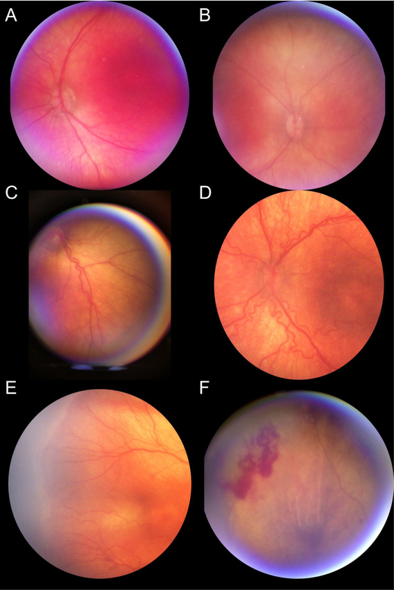 Figure 3: