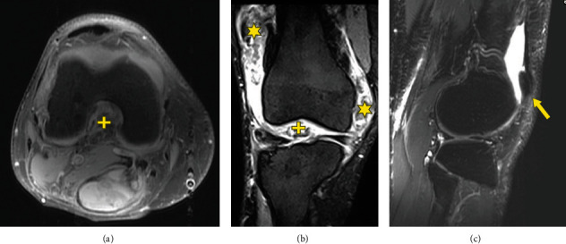 Figure 12