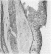 199