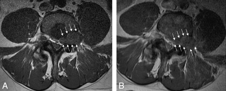 Fig 2.