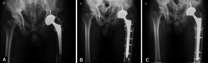 Fig. 2A–C