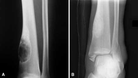 Fig. 1A–B