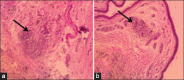 Figure-9