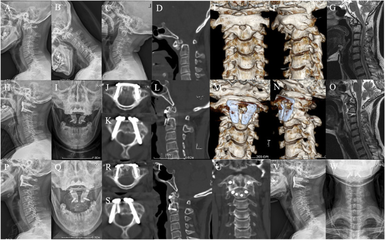 Figure 4.