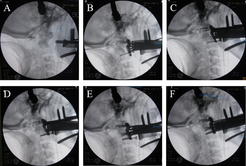 Figure 3.