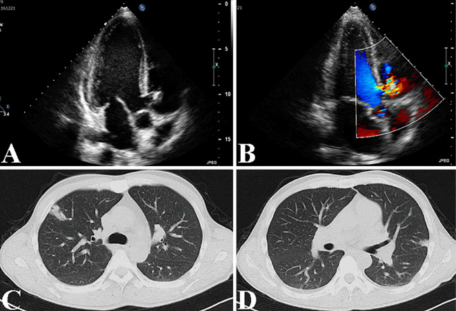 Figure 2.