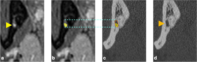 Fig. 5