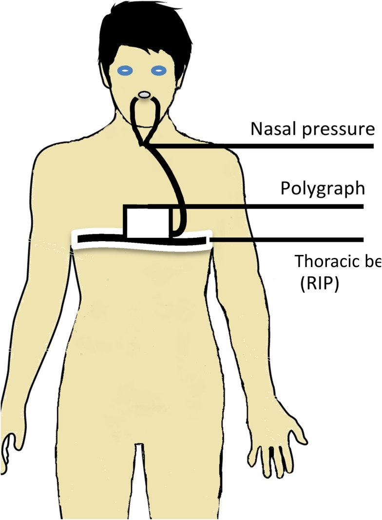 Fig 1