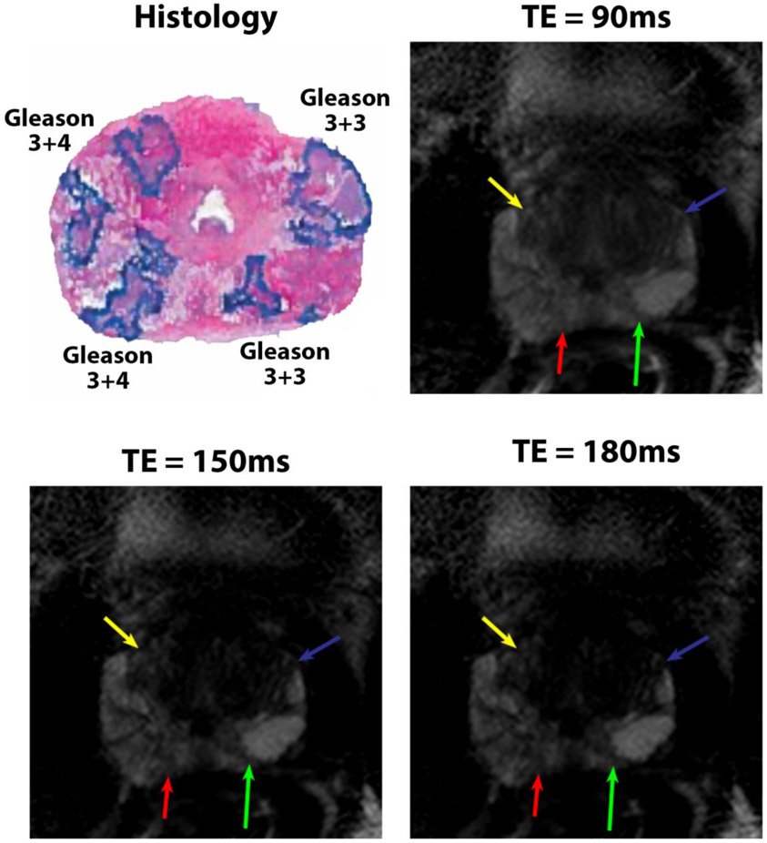 Figure 3: