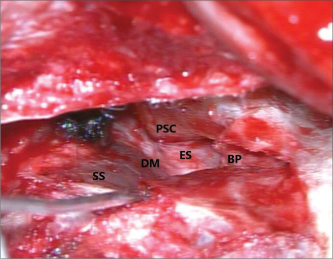 Figure 1: