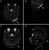 FIG. 2.