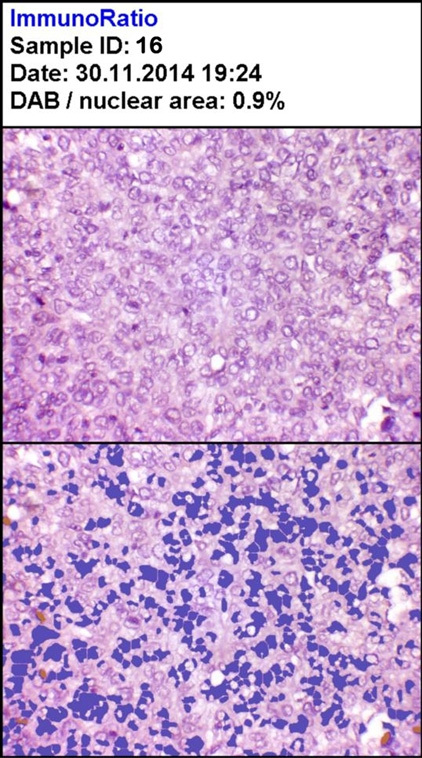 [Table/Fig-8]: