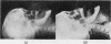 163