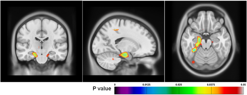 Fig. 3