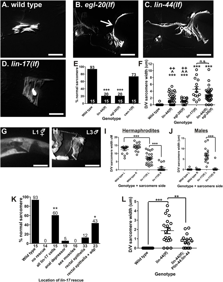 Fig. 3. WNT mutant anal depressor defects. (A-D) Fluorescent image of YFP:actin in the wild-type (A), egl-20(lf) (B), lin-44(lf) (C) and lin-17 (D) anal depressors. The arrow in B indicates dorsal-ventral sarcomere width measured in F,I,J and L. (E) Graph depicting the percentage of males with normal sarcomeres in the indicated mutants. Numbers above the bars give the percentage and numbers above the x-axis represent the total sample number for each line. ***P<0.0001, Fisher's exact test, compared with wild type. (F) Graph depicting the severity of the remodeling defects. Each circle represents the dorsal/ventral sarcomere width of either the left or right dorsal attachment in one male (see arrow in B). Data are mean±s.e.m. ***P<0.0001, Mann–Whitney t-test compared with wild type. ^P<0.05, ^^P<0.005, Mann–Whitney t-test compared with lin-44(lf);egl-20(lf). ++P<0.005, Mann–Whitney t-test compared with lin-17(lf). n.s., not significant. (G,H) Fluorescent images of YFP expressed from the lin-17 promoter. The anal depressor is at the center of the image. (I,J) Left (L) and right (R) dorsal-ventral sarcomere width in adult anal depressors. Each circle represents the width of the sarcomere on the indicated side of an individual animal. ***P<0.0001, Mann–Whitney t-test. (K) Graph depicting the percentage of males with normal sarcomeres. The x-axis indicates where wild-type lin-17 cDNA is expressed. The numbers on top of the bars represent the percentages. The number below the x-axis represents the total sample number for each location. *P<0.05, **P<0.005, Fisher's exact test, compared with no rescue. (L) lin-44(lf) anal depressor defects are rescued with a transgene. Each circle represents the dorsal/ventral sarcomere width of either the left or right dorsal attachment in one male (see arrow in C). Data are mean±s.e.m. **P<0.005, ***P<0.0001, Mann–Whitney t-test. For all images, dorsal is up and anterior is to the left. Scale bars: 10 µm.