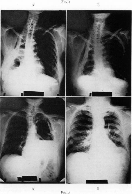 Fig. 1., Fig. 2.