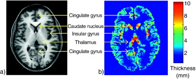 Fig. 6