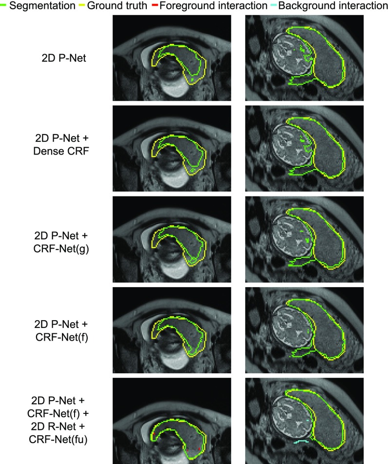 Fig. 7.