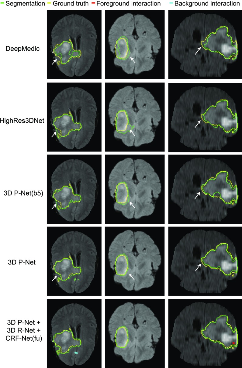 Fig. 11.