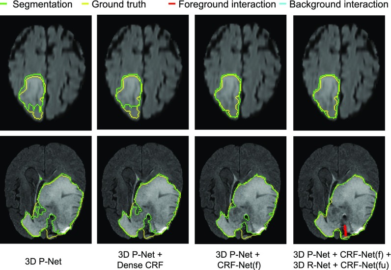 Fig. 12.