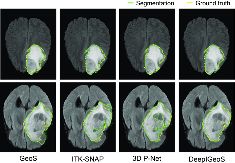 Fig. 14.