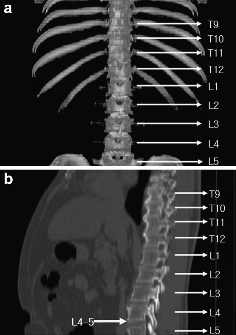 Fig. 1