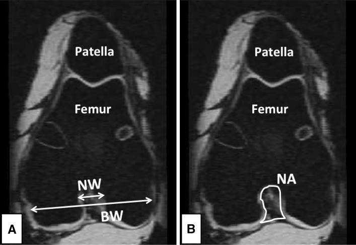 Fig. 3A–B