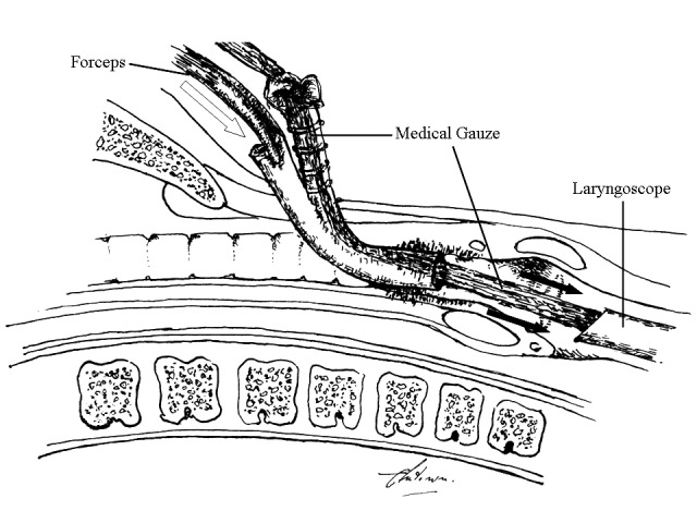 Fig. 2.