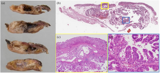 FIGURE 4