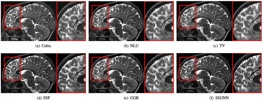 Fig. 11.