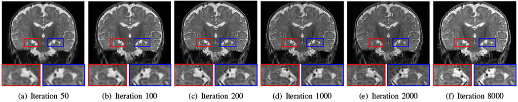 Fig. 12.