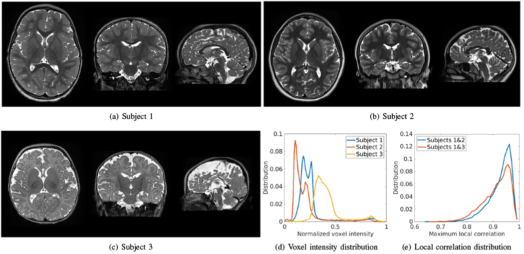 Fig. 14.