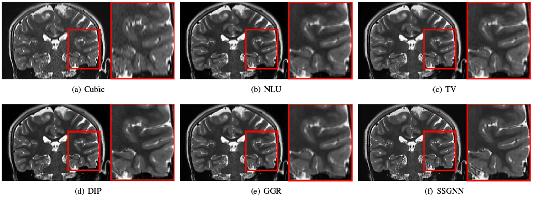 Fig. 10.