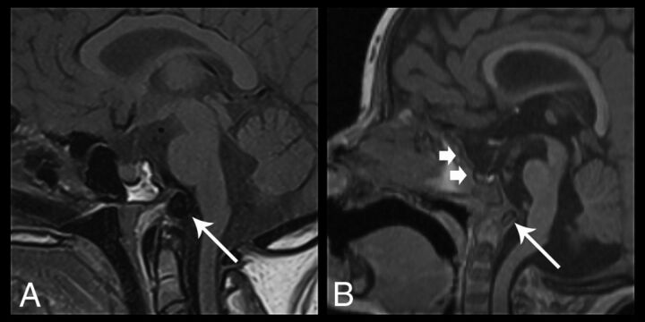 Fig 9.