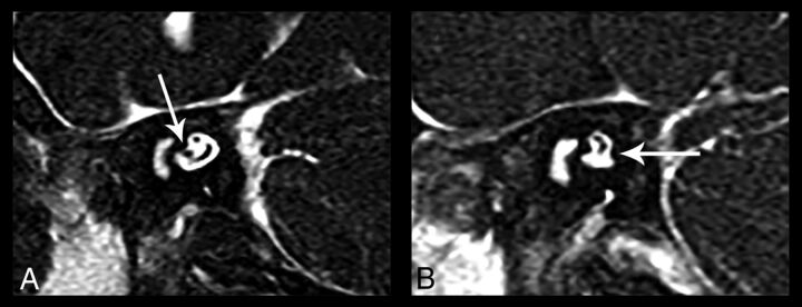 Fig 3.